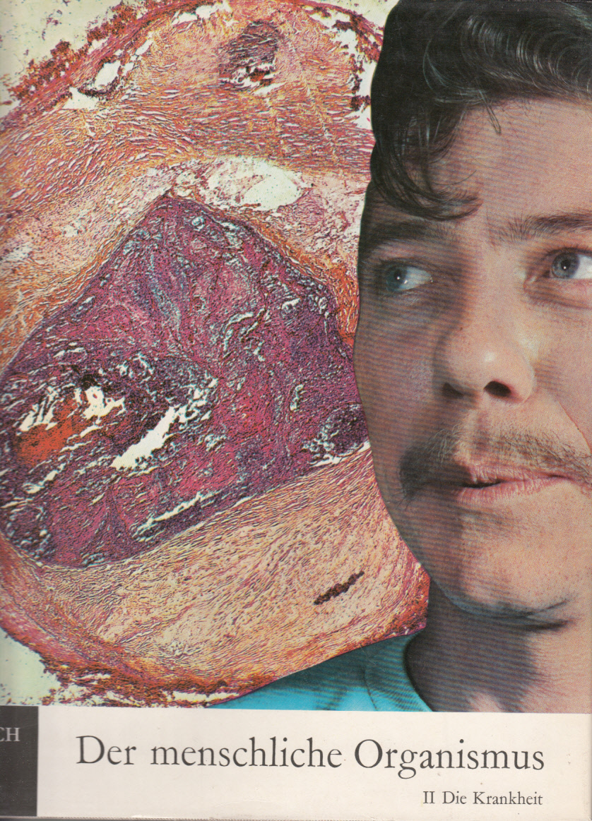 Der menschliche Organismus - II. Die Krankheit